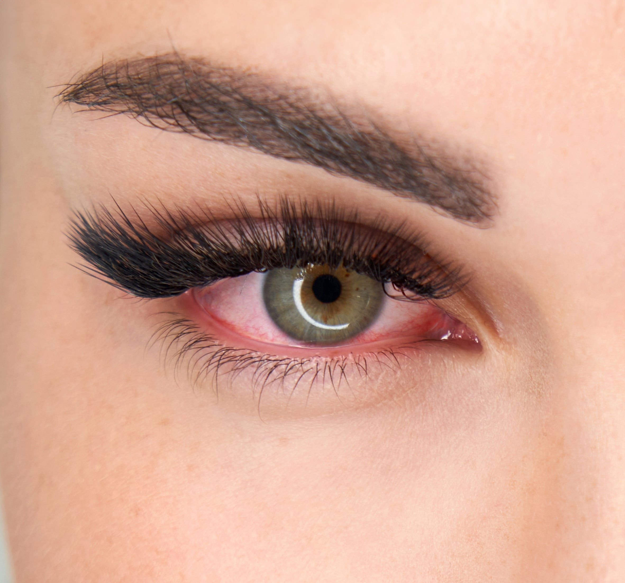 Cumulative Allergy Sneaks Up on You: A Guide for Lash Professionals - Stacy Lash