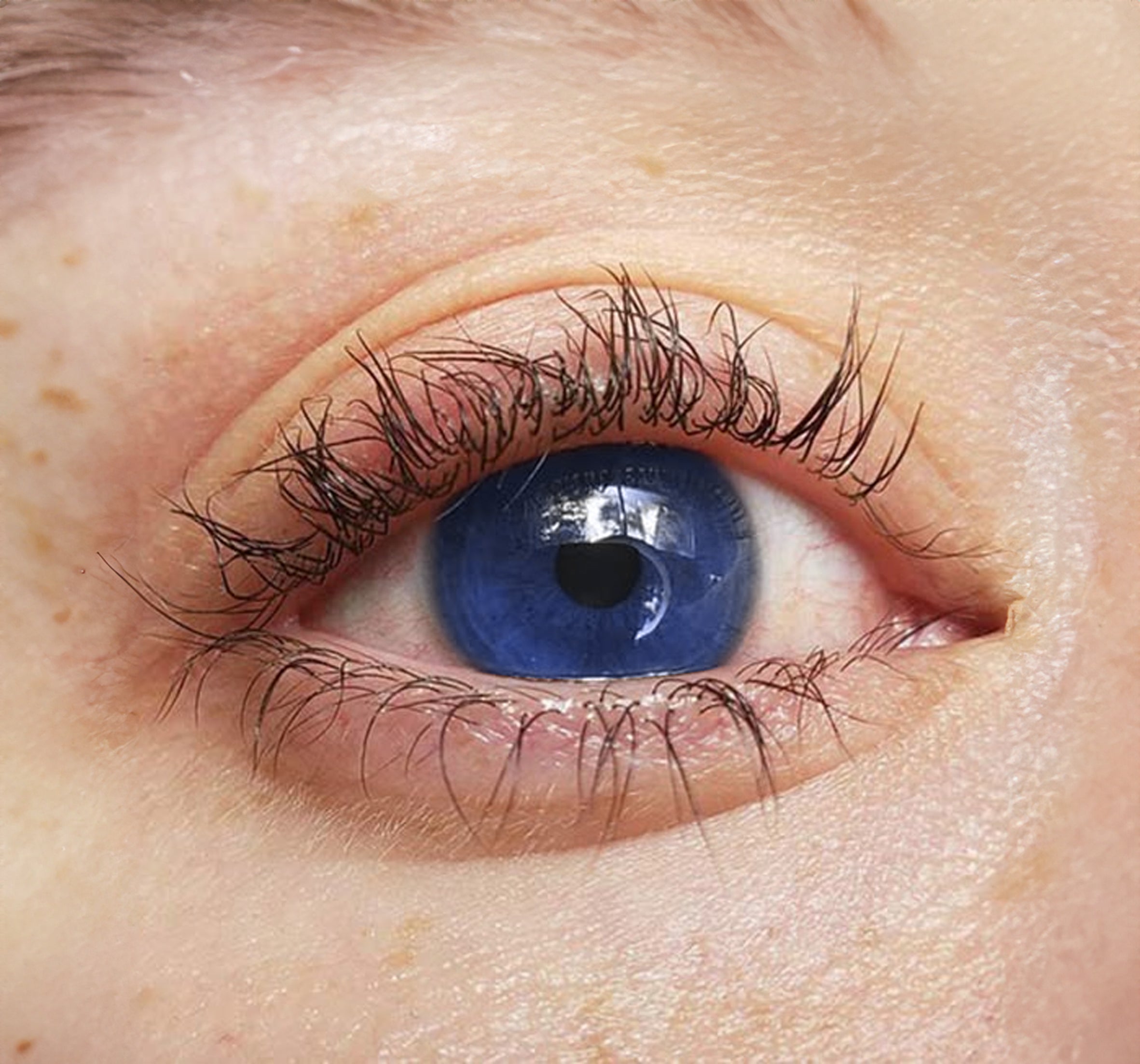 an eye with crooked eyelash