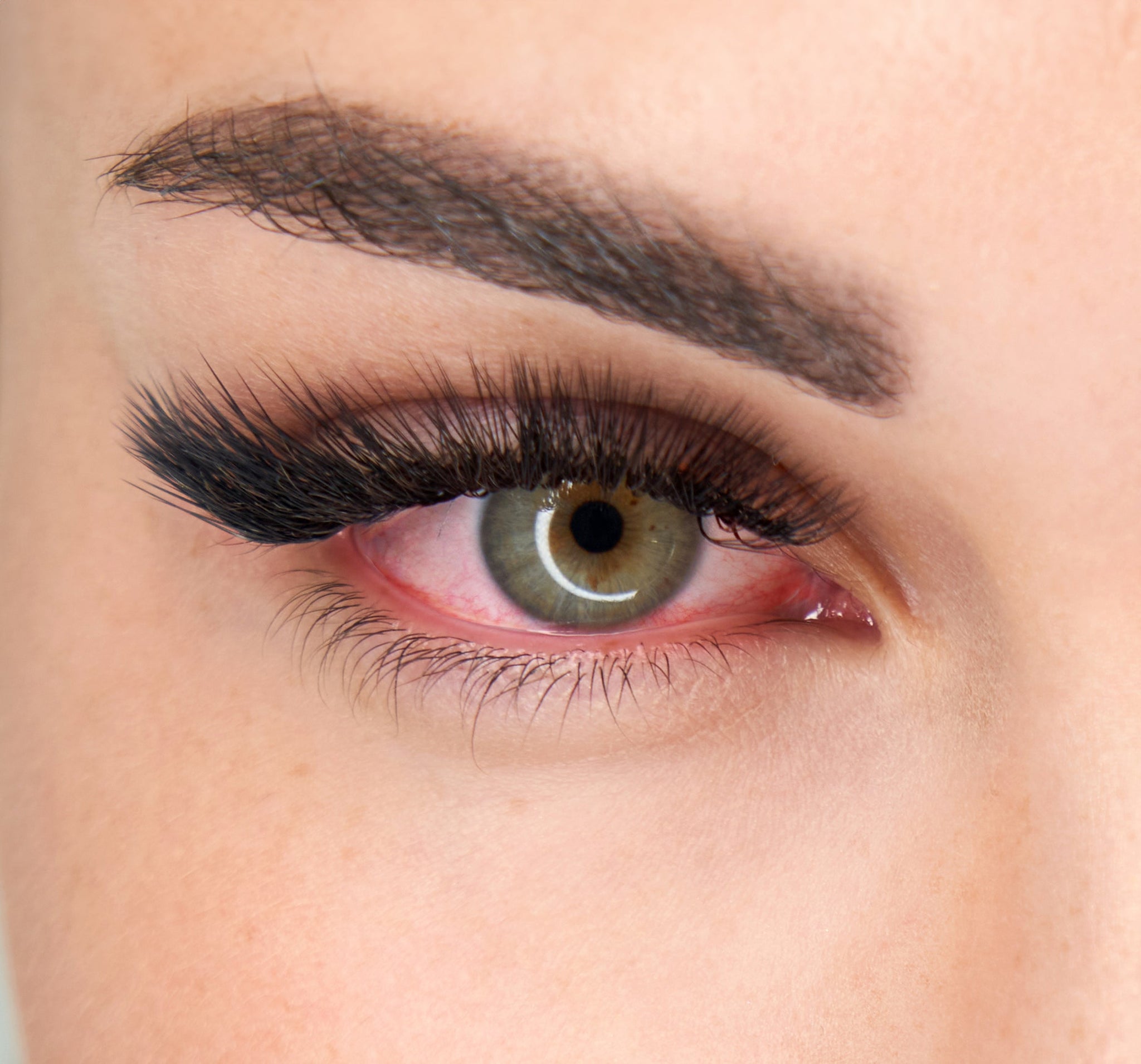 Cumulative Allergy Sneaks Up on You: A Guide for Lash Professionals