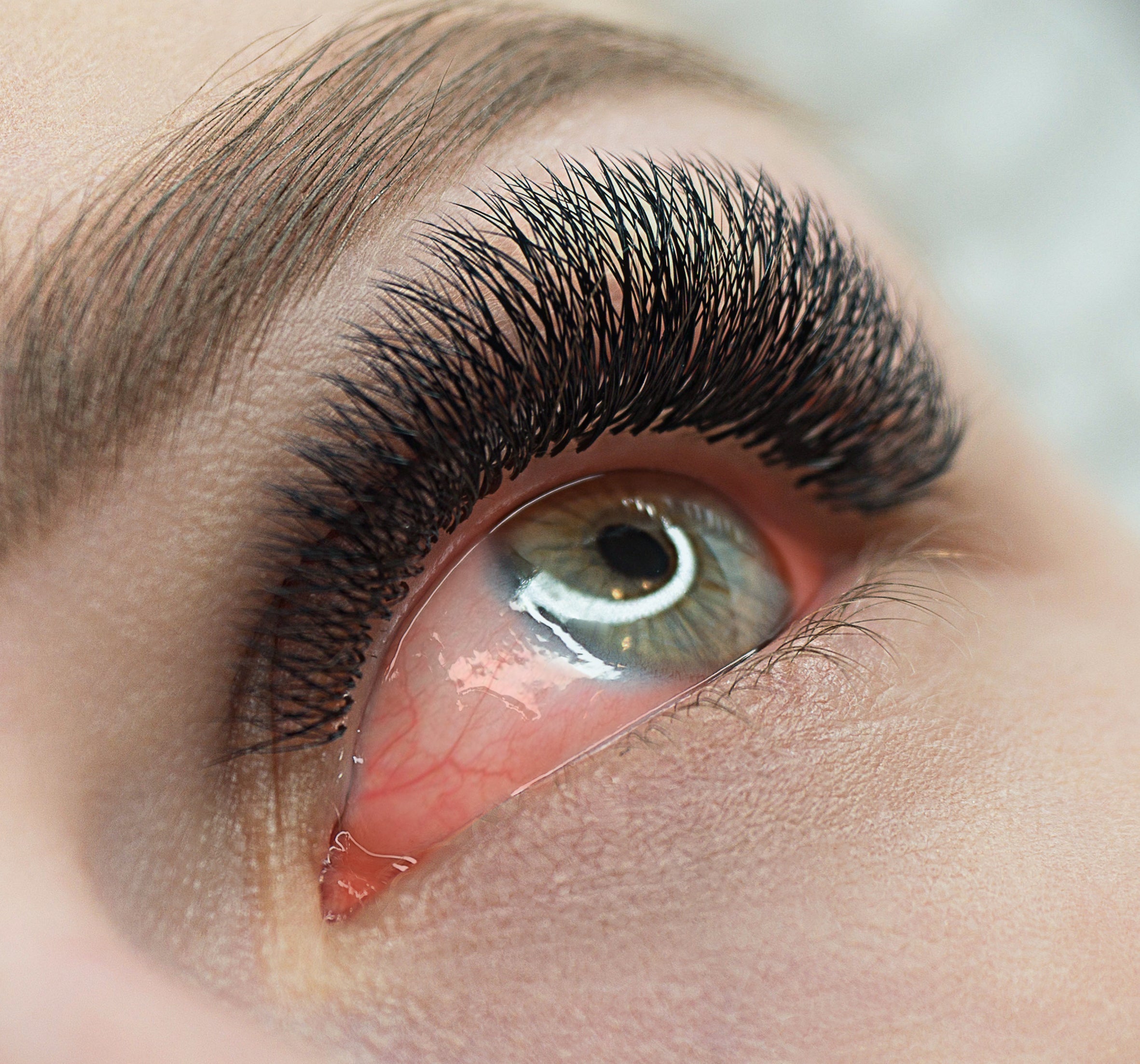 an irritated eye with eyelash extensions on