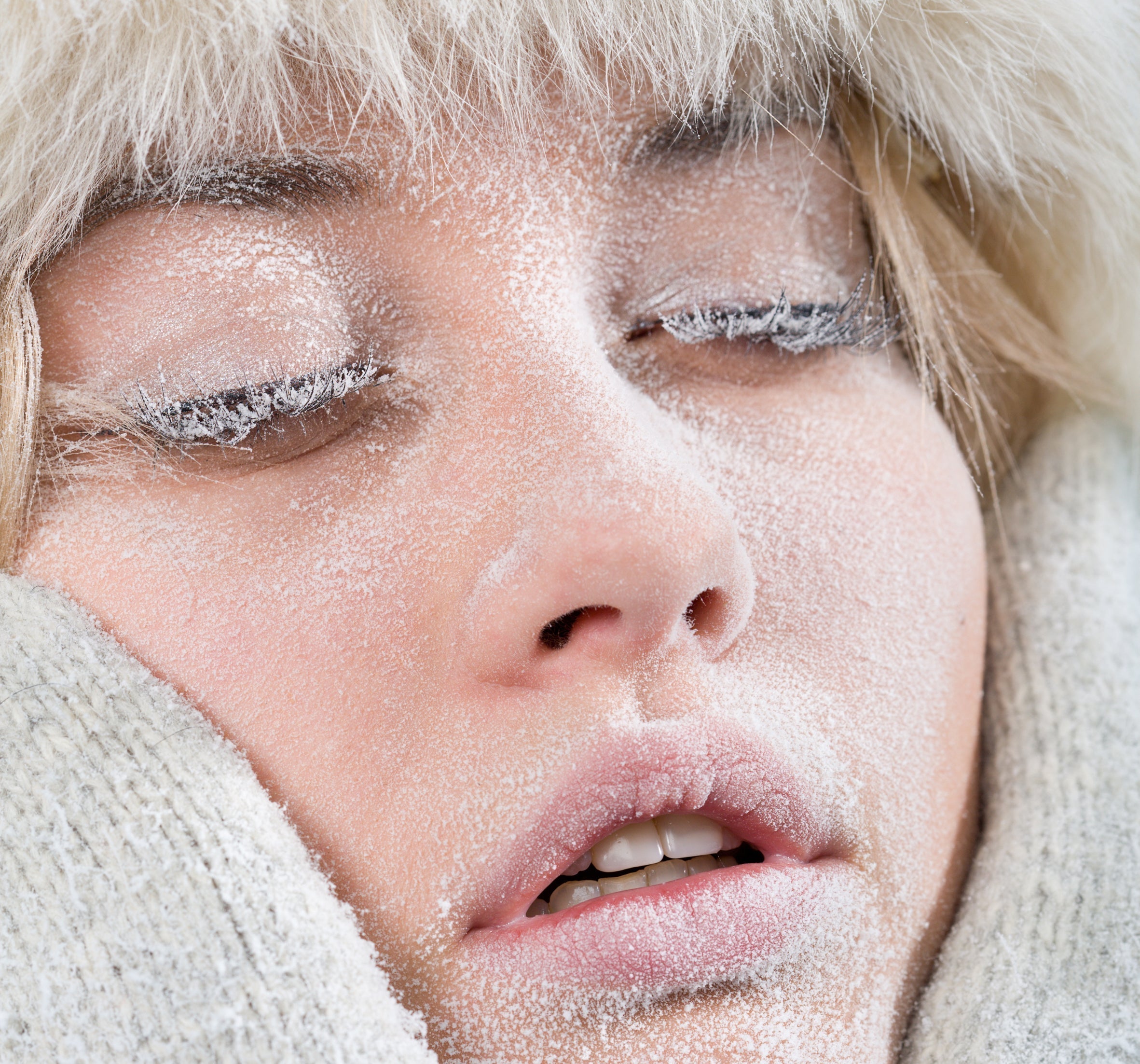 a face covered in snow and frozen